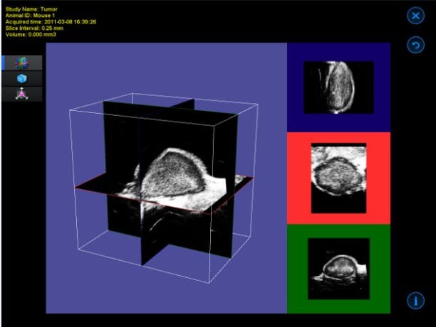 Ultrasound B-Mode Image Reconstruction 