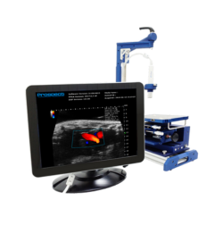 High-Frequency Ultrasound (Prospect T1)
