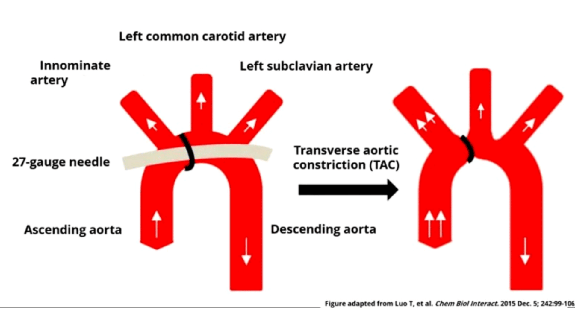 Transverse Aortic Constriction Diagram (TAC)