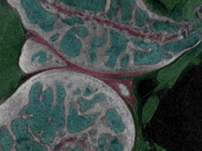 Gianluca Tozzi sample. - cartilage.red marrow.lightblue other soft.greenpng