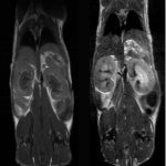 Anatomy & Morphology of mouse abdomen: T1- and T2- weighted scans of wildtype mouse body abdomen